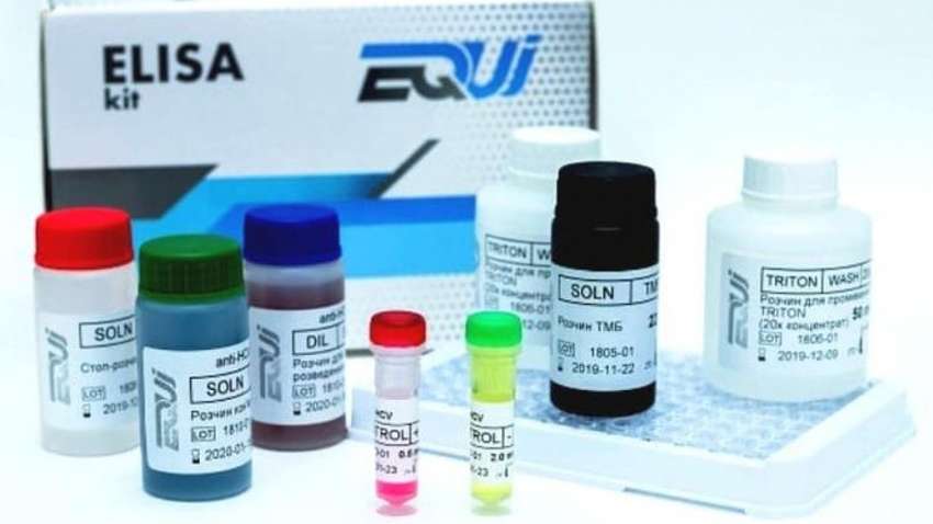 «Эквитестлаб» утаила информацию о проведении обысков 