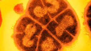 Она таки существует: самая "живучая" бактерия, которая не боится радиации и космического вакуума Она таки существует: самая "живучая" бактерия, которая не боится радиации и космического вакуума