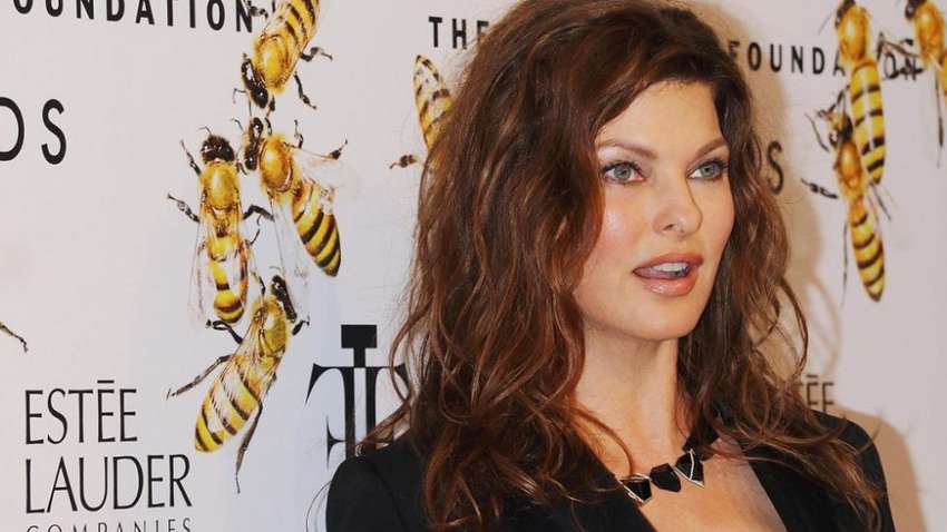 Канадская модель завершила карьеру через косметические операции