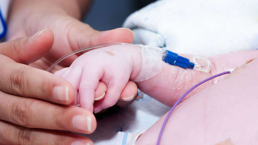 У Португалії народилася дитина "без обличчя" 