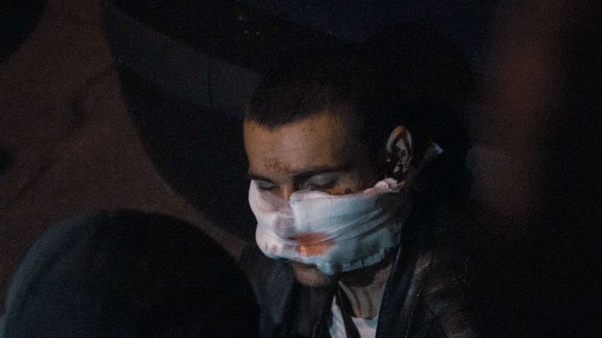 В Киеве вор хотел ограбить офис депутата и был подстрелен