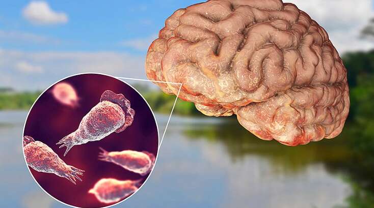 Смертельна амеба "з'їла" мозок жінки в США під час відпустки Смертельна амеба "з'їла" мозок жінки в США під час відпустки