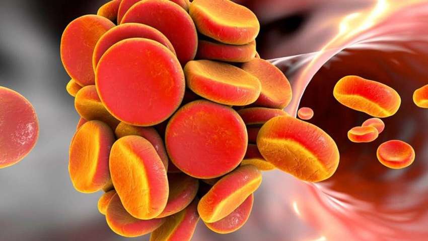 Ученые выяснили, почему у больных COVID-19 появляются тромбы