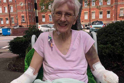 Женщина попала в больницу с камнями в почках и лишилась конечностей