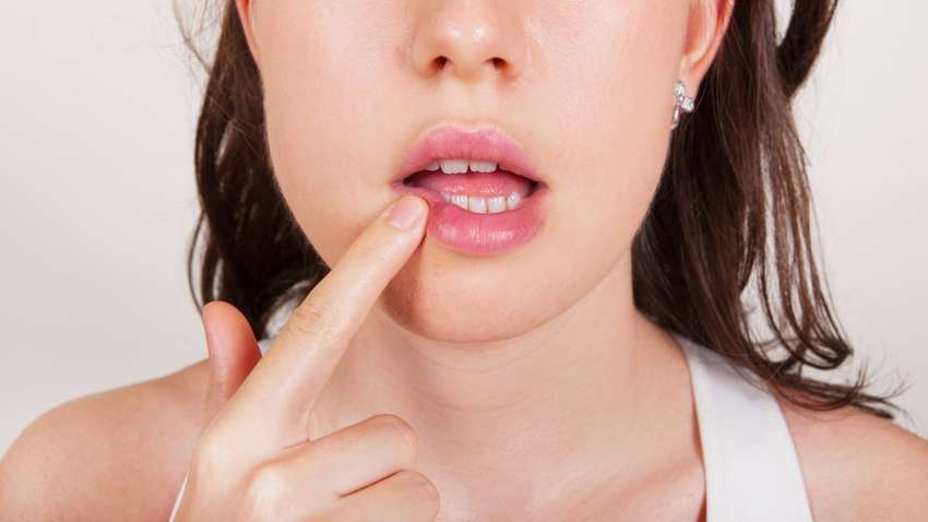 Почему появляется герпес на губах: основные причины