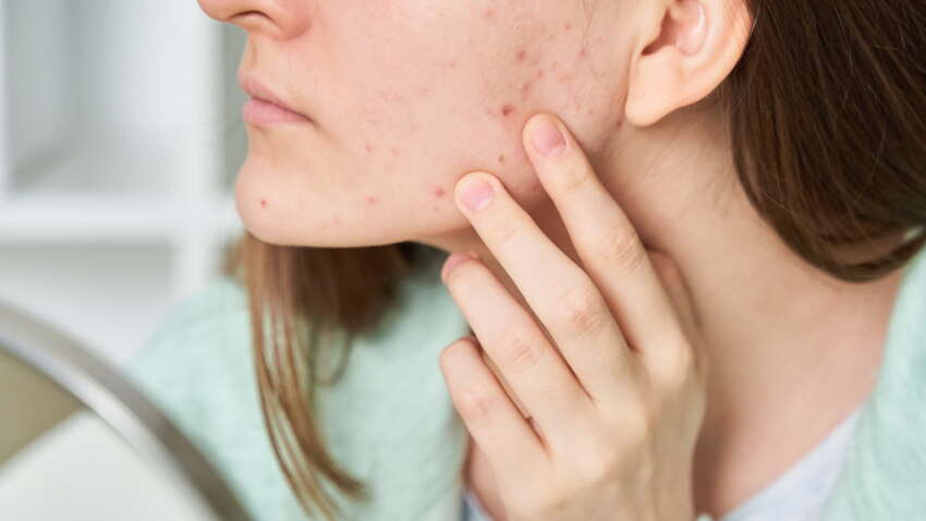 Эта проблема с кишечником может привести к высыпанию: не игнорируйте ее