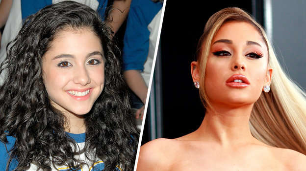 Як виглядають знаменитості до та після пластики