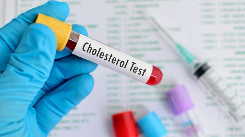 Три признака, указывающих на повышенный холестерин