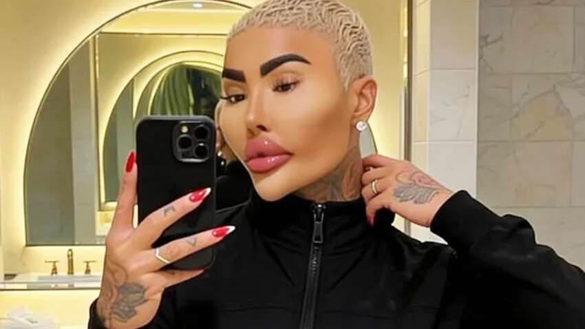 "Король губ" з Британії помер під час пластичної операції (ФОТО) "Король губ" з Британії помер під час пластичної операції (ФОТО)