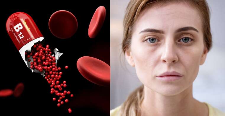 Как распознать дефицит витамина B12: почему его нельзя игнорировать Как распознать дефицит витамина B12: почему его нельзя игнорировать