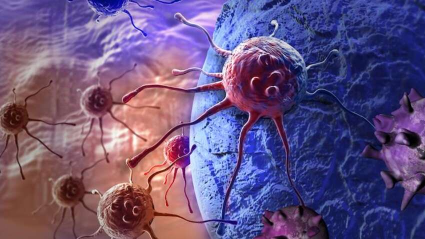 10 найсмертельніших видів раку: які шанси вижити 10 найсмертельніших видів раку: які шанси вижити