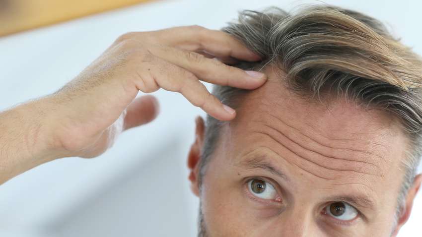 Эти 5 продуктов помогут предотвратить облысение: совет диетолога