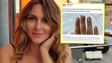 Росіянка відкусила пальця польці, потім виплюнула його і почала сміятися: скрізь була кров