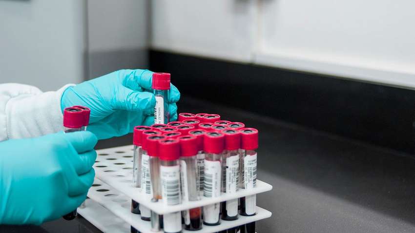 Стало известно, какая группа крови снижает риск диабета Стало известно, какая группа крови снижает риск диабета