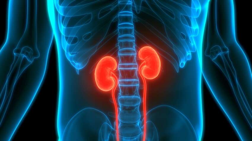 Каміння у нирках перестане бути проблемою завдяки цим продуктам: нове відкриття вражає Каміння у нирках перестане бути проблемою завдяки цим продуктам: нове відкриття вражає