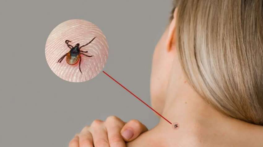 Группа крови, которую клещи выбирают меньше всего Группа крови, которую клещи выбирают меньше всего