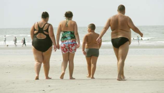 У Росії збиток на трильйони: влада звинувачує людей з ожирінням У Росії збиток на трильйони: влада звинувачує людей з ожирінням