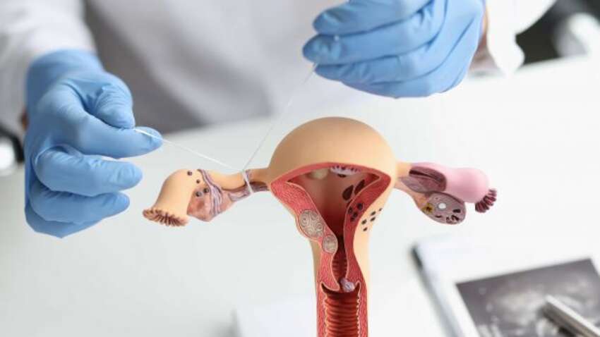 Попит на стерилізацію серед молодих американок б’є рекорди — політика та страх змінюють життя