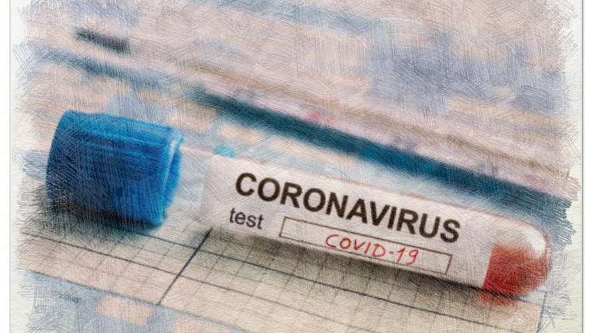 В Минздраве объяснили, почему украинцев массово не тестируют на коронавирус