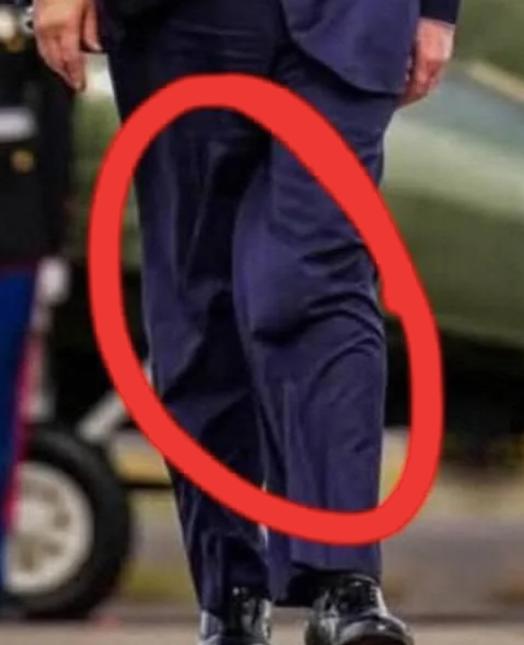 У Трампа помітили дещо дивне на нозі: що це може бути (ФОТО) - фото 2 У Трампа помітили дещо дивне на нозі: що це може бути (ФОТО) - фото 2