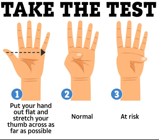 Простий тест великим пальцем може врятувати життя: як перевірити своє здоров'я - фото 2 Простий тест великим пальцем може врятувати життя: як перевірити своє здоров'я - фото 2