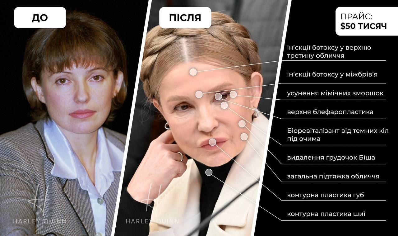 Тимошенко теряет позиции: сколько стоит пиджак лидера ”Батькивщины” - фото 2