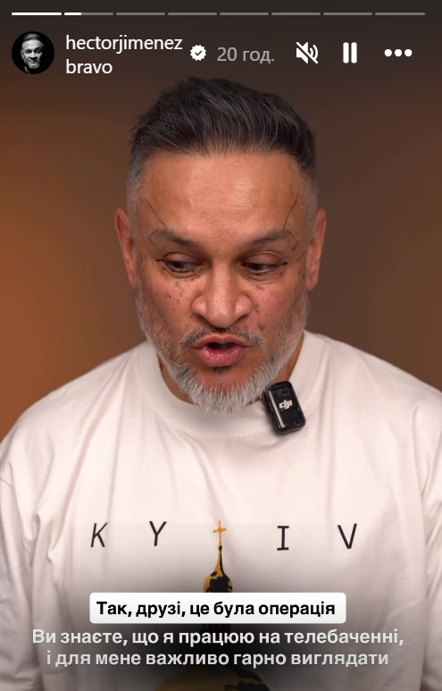 Эктор Хименес-Браво сделал пластическую операцию на лице: показал первые фото - фото 2