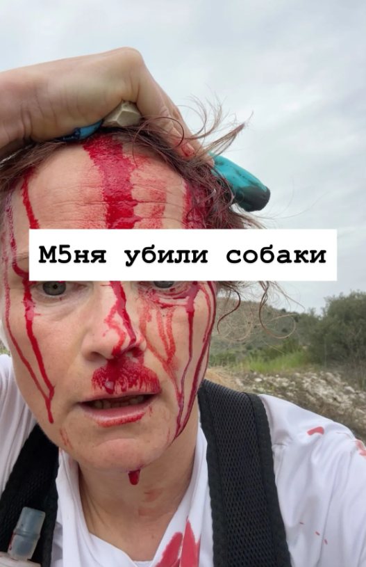 ”Відірвали половину голови”: чемпіонка Росії постраждала від нападу зграї собак (ФОТО) - фото 2 ”Відірвали половину голови”: чемпіонка Росії постраждала від нападу зграї собак (ФОТО) - фото 2