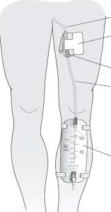 У Трампа помітили дещо дивне на нозі: що це може бути (ФОТО) - фото 2 У Трампа помітили дещо дивне на нозі: що це може бути (ФОТО) - фото 2