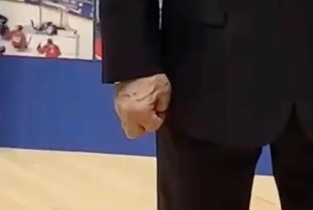 Что с ними не так: появились загадочные фото рук Путина - фото 2 Что с ними не так: появились загадочные фото рук Путина - фото 2