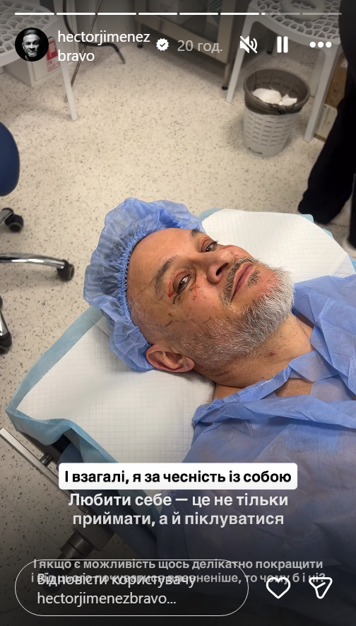 Эктор Хименес-Браво сделал пластическую операцию на лице: показал первые фото - фото 2