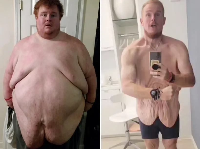 Чоловік схуд на 270 кг: як він зараз виглядає (ФОТО) - фото 2 Чоловік схуд на 270 кг: як він зараз виглядає (ФОТО) - фото 2