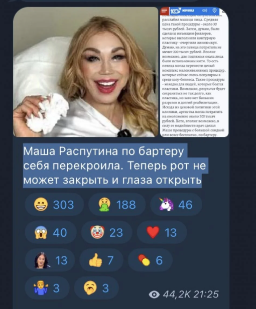 Не відкриваються очі і не закривається рот: російська співачка, що підтримує режим Кремля, омолодилася - фото 2