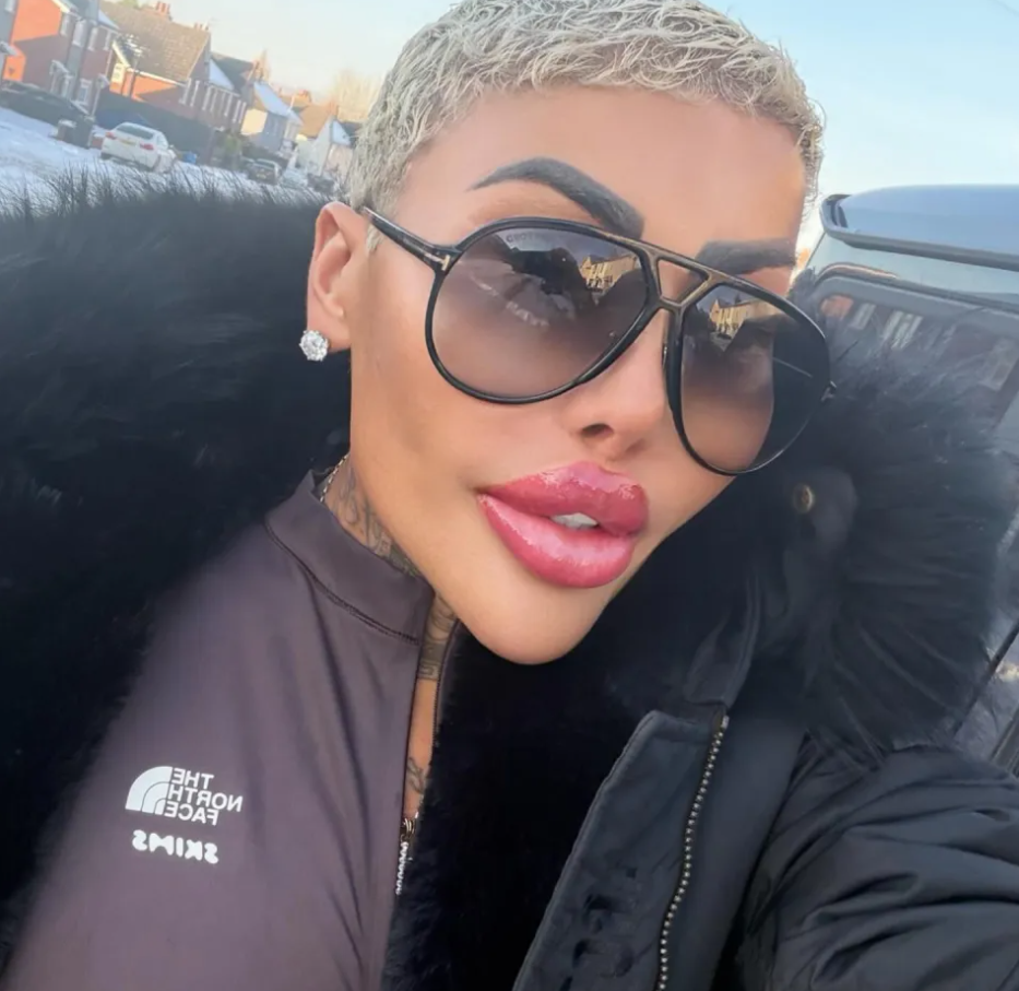 ”Король губ” з Британії помер під час пластичної операції (ФОТО) - фото 2 ”Король губ” з Британії помер під час пластичної операції (ФОТО) - фото 2