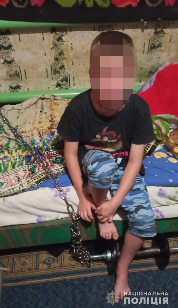 В Кривом Роге отчим держал на цепи 7-летнего ребенка: зачем он это делал - фото 2