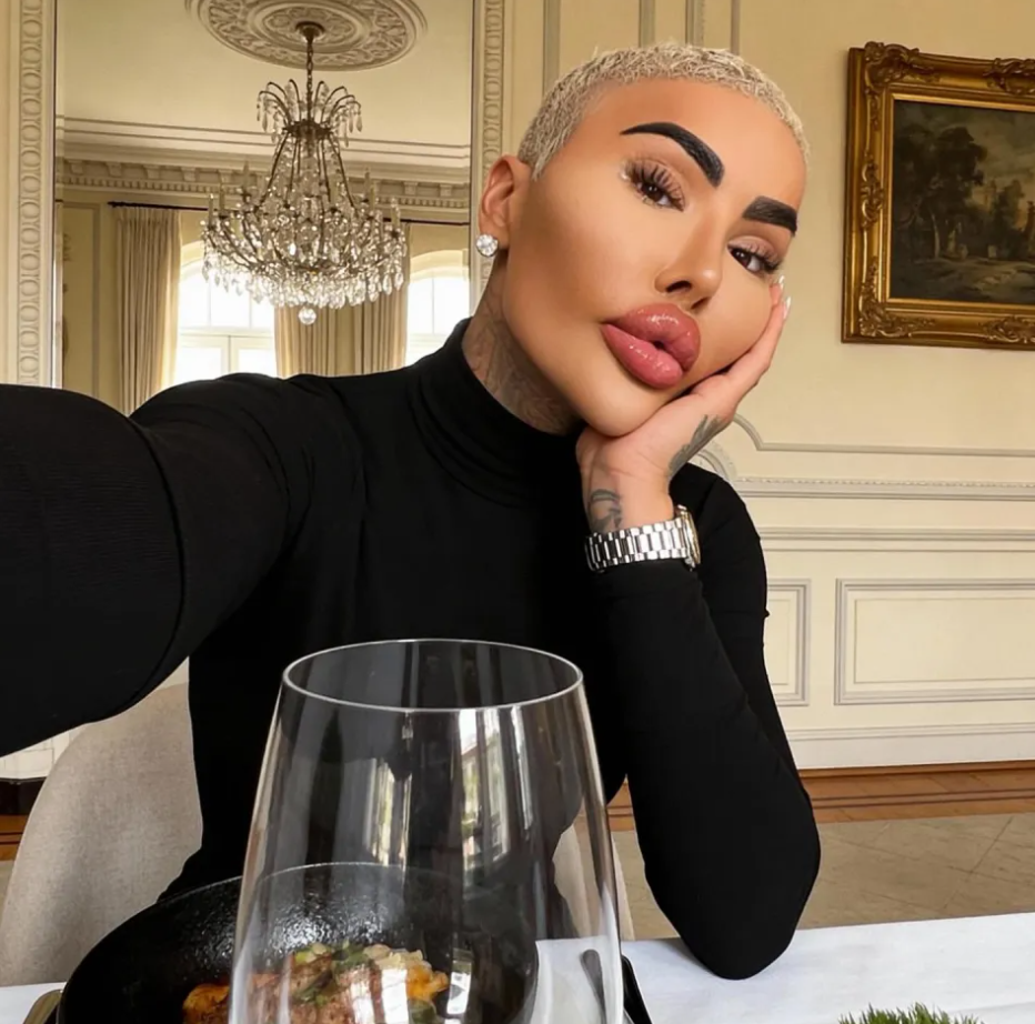 ”Король губ” з Британії помер під час пластичної операції (ФОТО) - фото 2 ”Король губ” з Британії помер під час пластичної операції (ФОТО) - фото 2