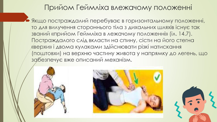 Прийом Геймліха: як врятувати людину, що задихається (ФОТО) - фото 7