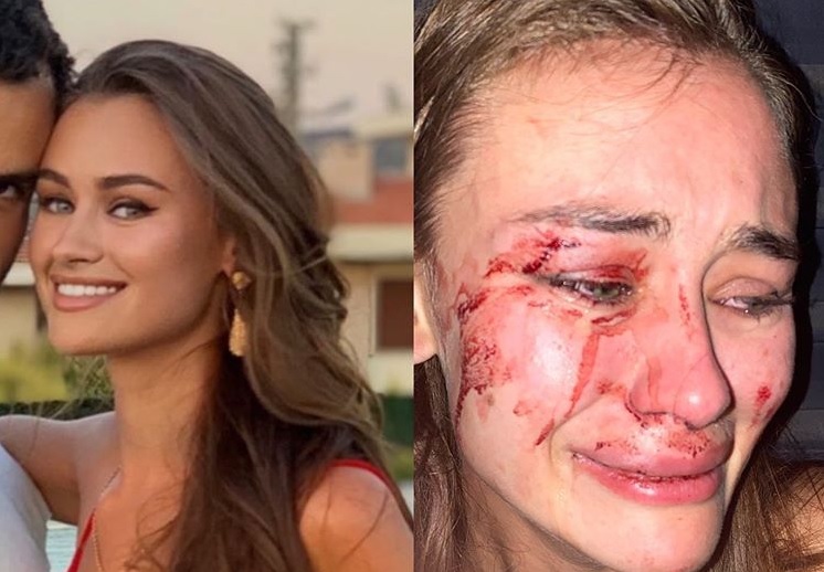 У Туреччині на пляжі жорстоко побили українську модель та її подруг - фото 2