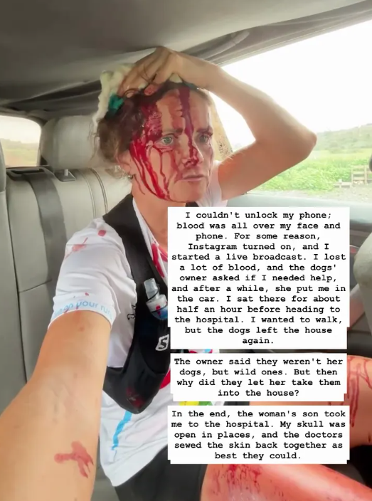 ”Відірвали половину голови”: чемпіонка Росії постраждала від нападу зграї собак (ФОТО) - фото 2 ”Відірвали половину голови”: чемпіонка Росії постраждала від нападу зграї собак (ФОТО) - фото 2