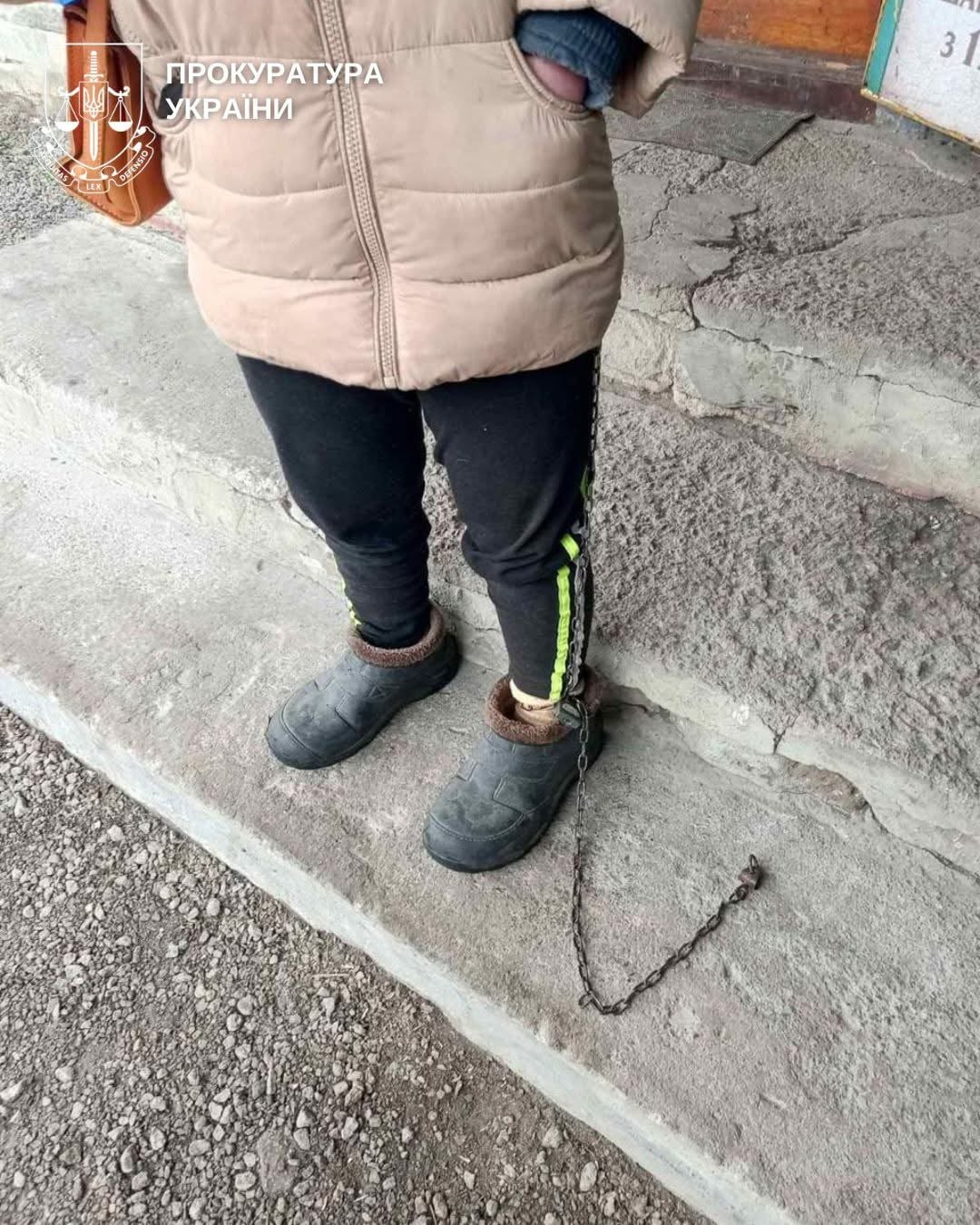 Скандал у дитбудинку: дівчинку з інвалідністю тримали на ланцюгу  - фото 2