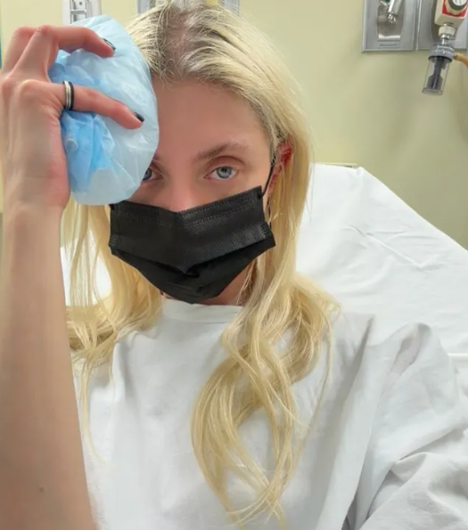 Известную певицу срочно доставили в больницу после укуса ядовитого паука - фото 2