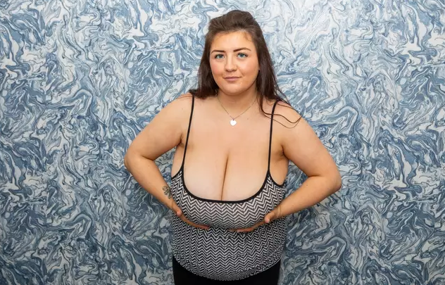 В Британии женщина с самой большой грудью не может сделать операцию по их уменьшению по странной причине (ФОТО) - фото 2