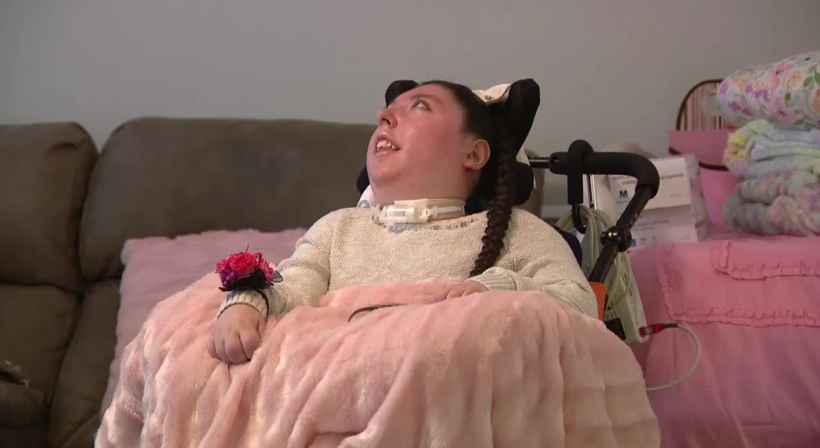 Женщина без мозга отпраздновала 20 лет: что известно о ее редкой болезни - фото 2