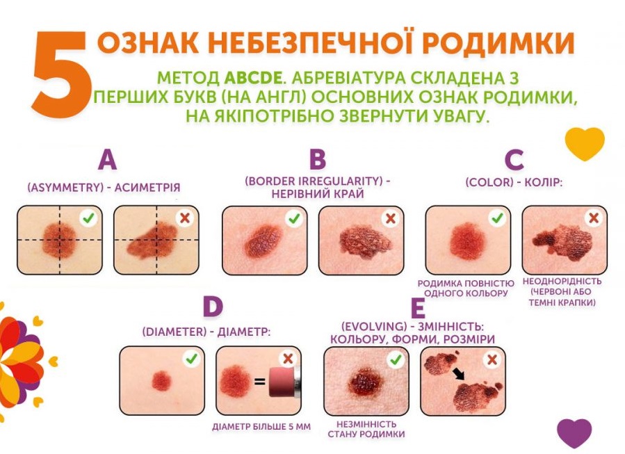 Рак кожи: что это такое и каковы его первые симптомы - фото 2