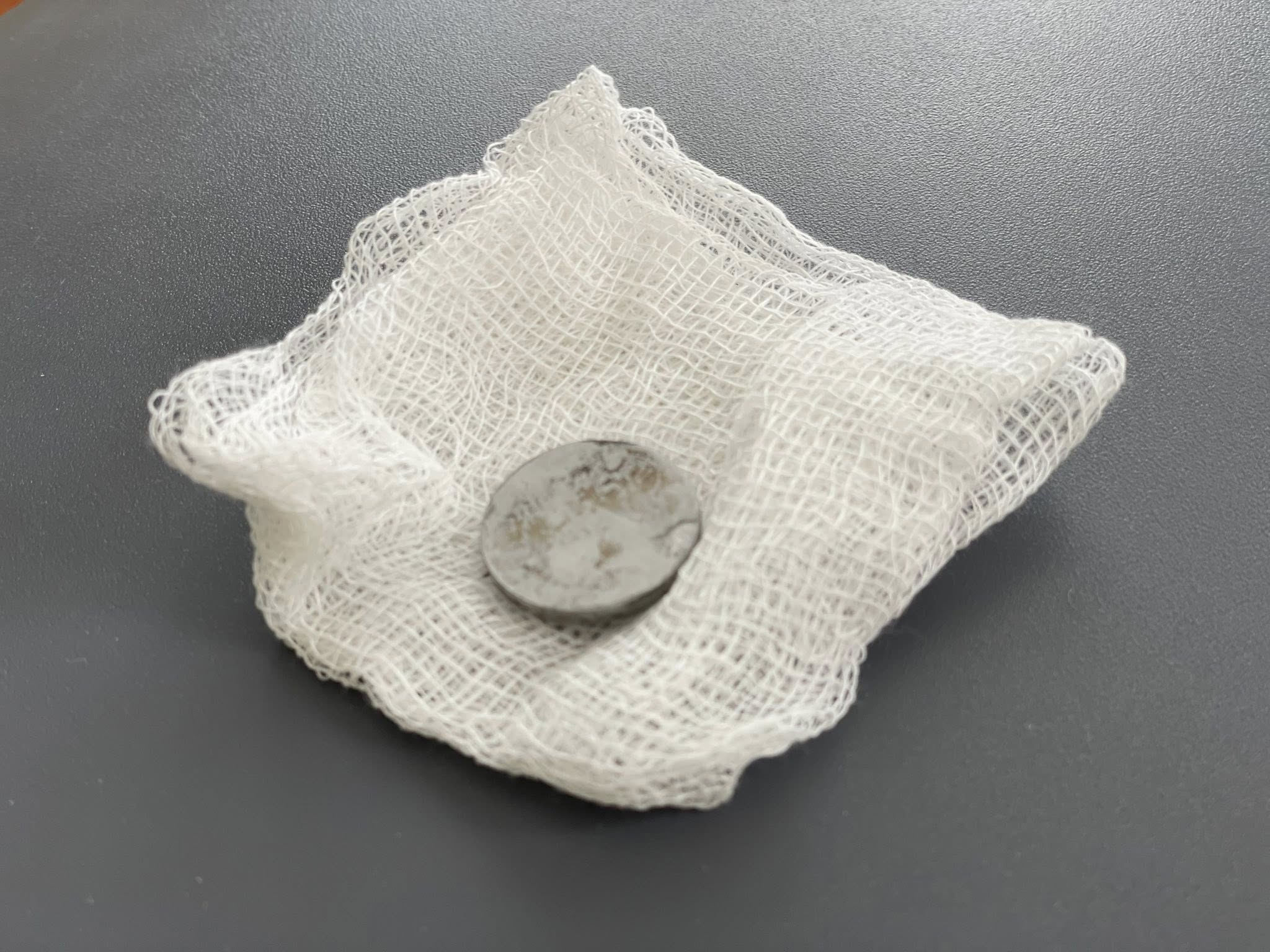 Дворічна дитина у Львові прожила всю зиму з батарейкою у стравоході: що сталося далі - фото 2