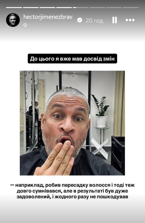 Эктор Хименес-Браво сделал пластическую операцию на лице: показал первые фото - фото 2