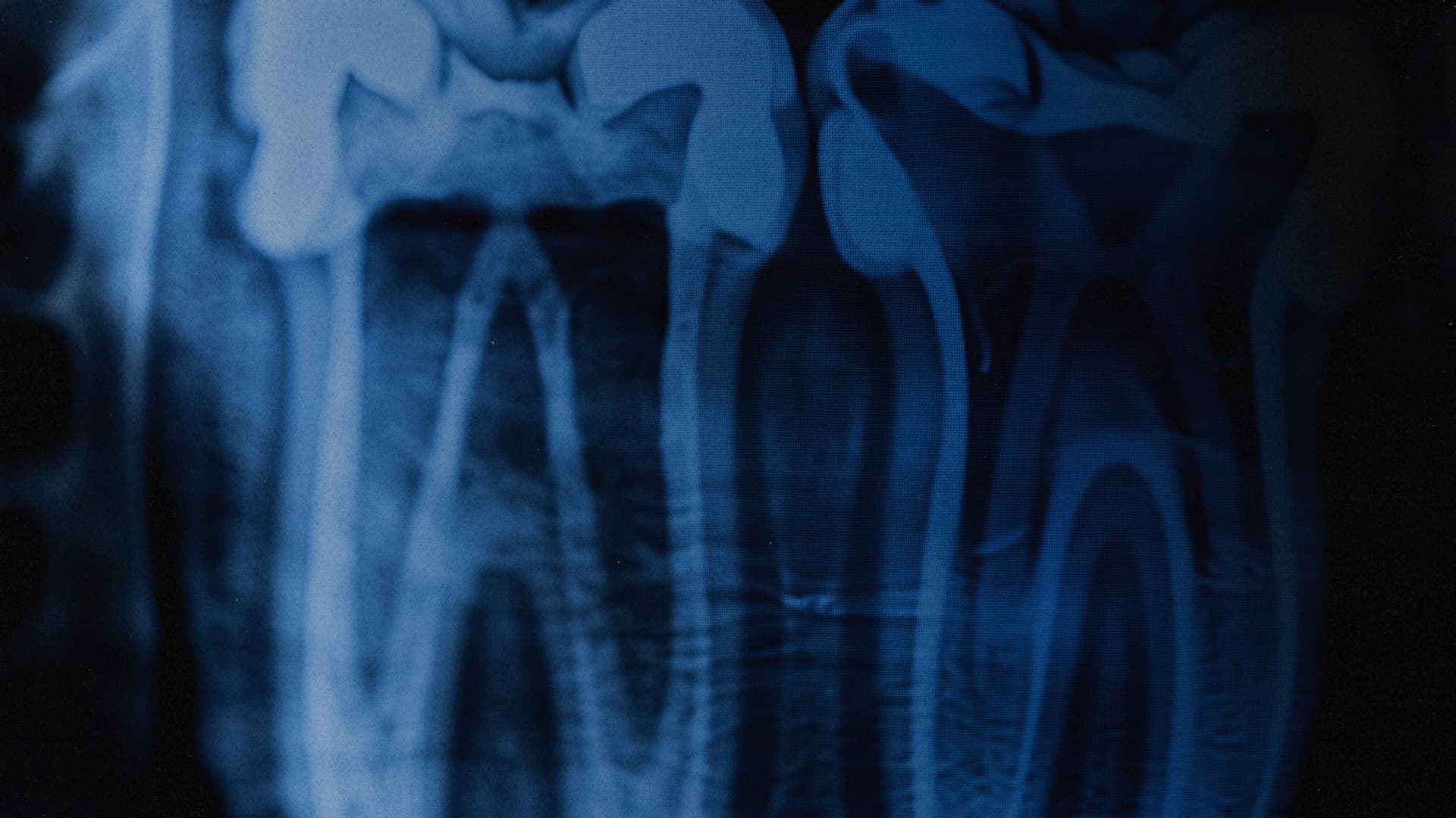 Проєкт Re:Smile: все про стоматологічну реабілітацію ветеранів 12-ої бригади «Азов» - фото 2