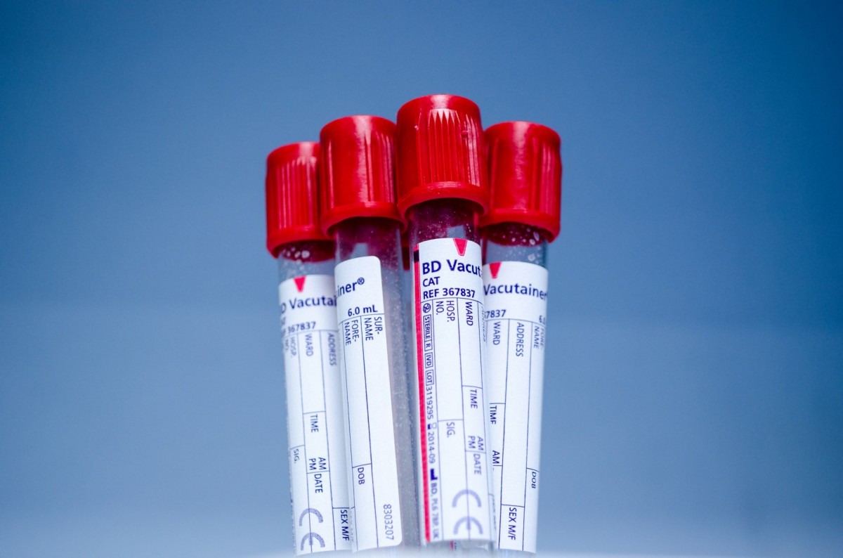 Важное открытие: канадские ученые научились менять группу крови
