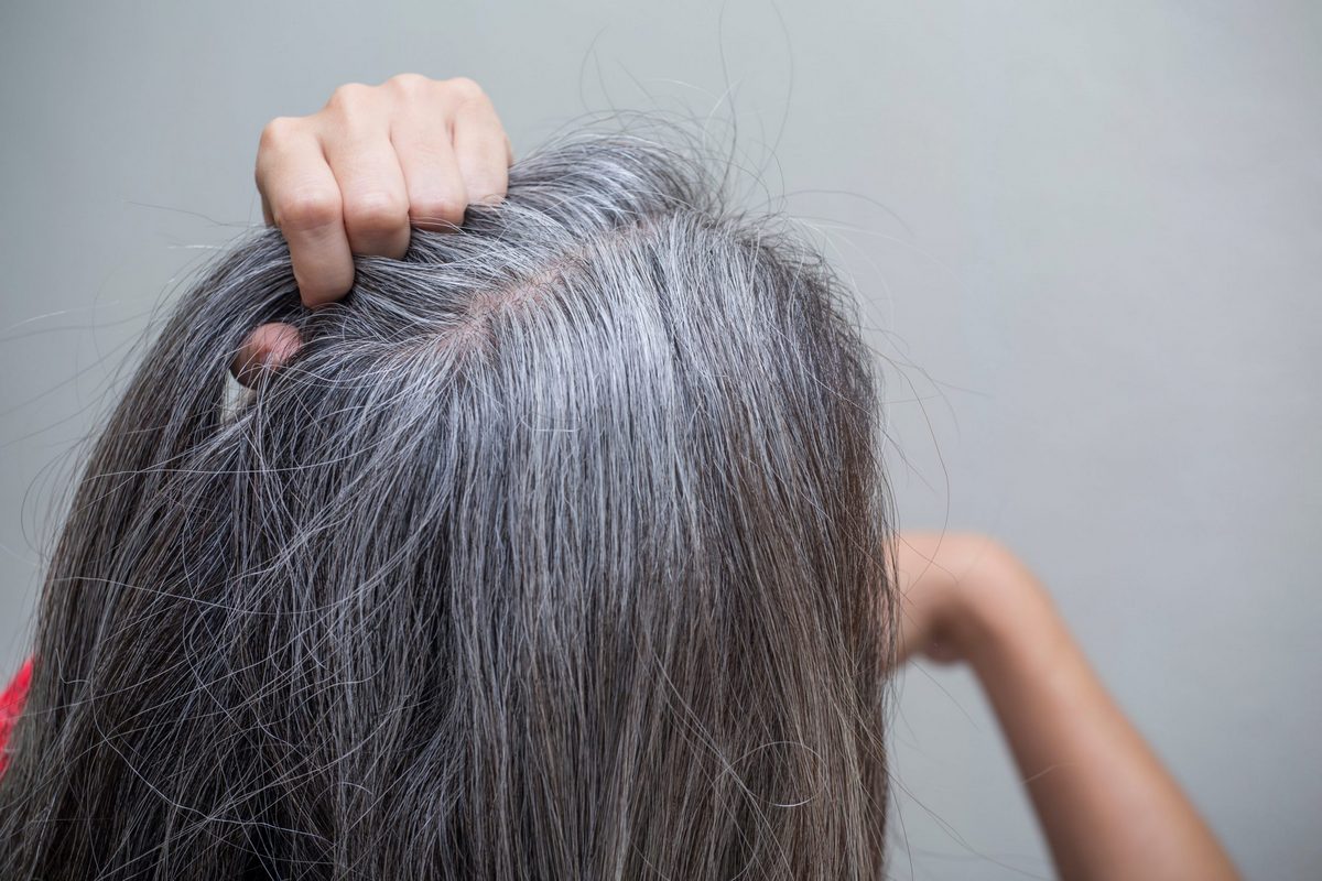 Почему седеют волосы в молодом возрасте и можно ли это остановить