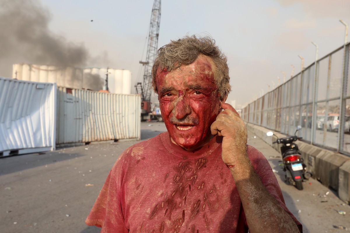 Окровавленные люди и тонны железа: как сейчас выглядит разрушенный взрывами Бейрут (ФОТО) - фото 3
